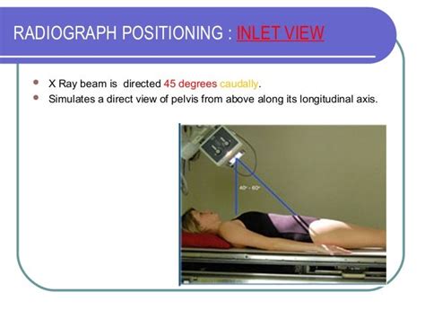 Pelvic Fractures Classification And Management