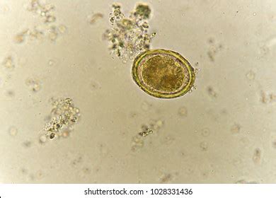 Egg Ascaris Lumbricoides Roundworm Stool Analyze Foto Stock 1028331436