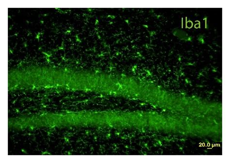 Microgliosis Indicated By Iba Immunostaining In Hippocampus At Wks