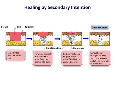 secondary intention healing - pictures, photos