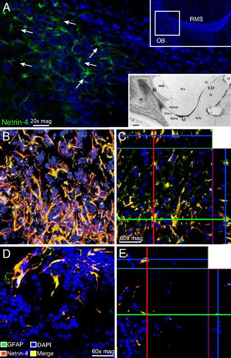 Discovery Of A Functional Protein Complex Of Netrin Laminin Chain