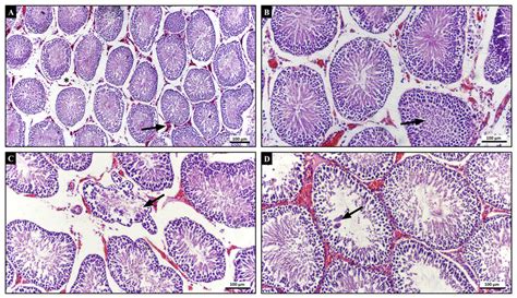 Representative Photomicrographs Of Hande Stained Testicular Sections Of