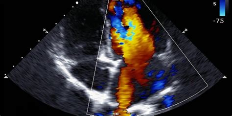 Coloured Doppler Ultrasonography Bolge Hospital International