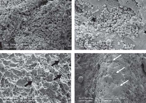 Effectiveness Of A Super Pulsed Co2 Laser For Removal Of Biofilm From Three Different Types Of