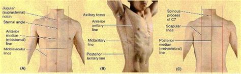 A35 Thoracic Wall Flashcards Quizlet