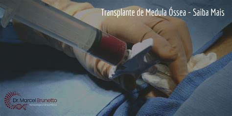 Transplante de Medula Óssea Saiba Mais Dr Marcel Brunetto