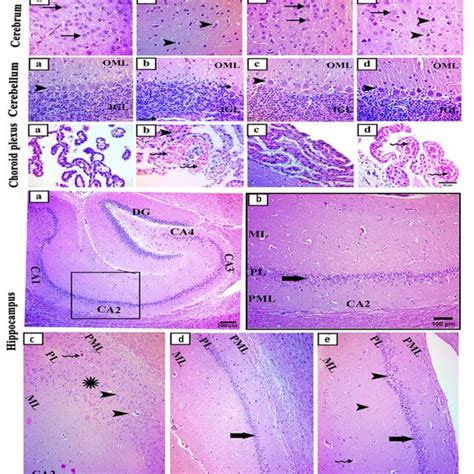 Representative Photomicrographs Of Ki 67 Immunohistochemical Stained