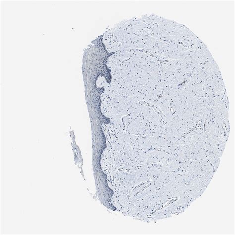 Tissue Expression Of Map3k20 Staining In Vagina The Human Protein Atlas