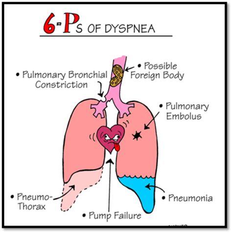 Nurs 202 Patho RESPIRATORY SYSTEM DISORDERS Acid Base Flashcards