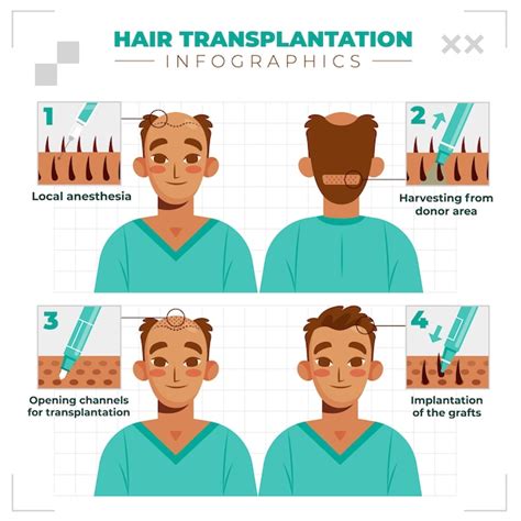 Premium Vector Hair Transplant Flat Cartoon Infographics