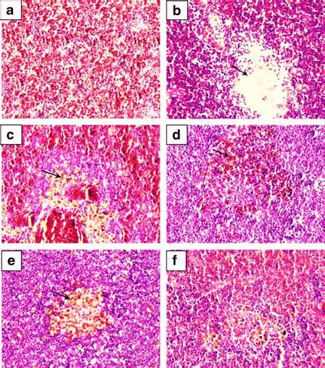 H E Stained Sections Of Spleen Ac Of Nile Tilapia Infected With A