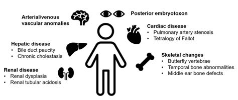 The Real Deal Behind Alagille Syndrome Aasld