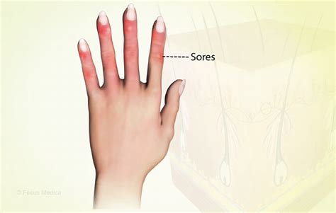 Health Condition : Symptoms, Causes, Treatment and More