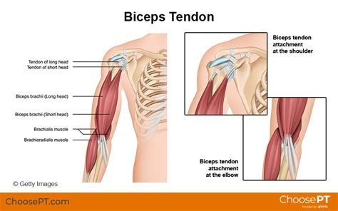 Physical Therapy Guide To Biceps Tendon Rupture — Pro Dynamic Physical Therapy Inc