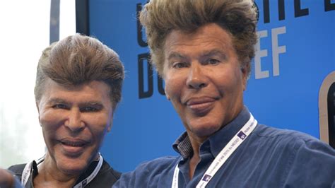 Igor And Grichka Bogdanoff Extreme Plastic Surgery Disasters And Why They Do It Au