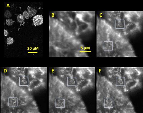 Confocal And STED Images Of Live Rat Chondrocyte Cells Transfected With