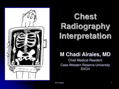 PPT - Chest Radiography Interpretation PowerPoint Presentation, free ...