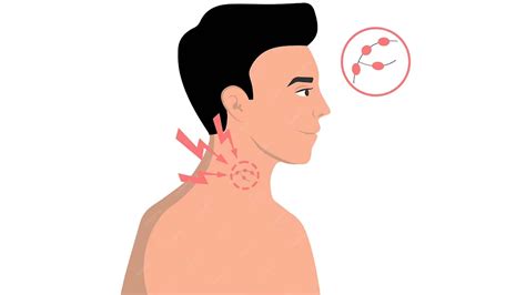 Causes of swollen supraclavicular lymph nodes - isseshoppe