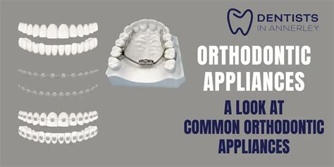 Shaping Smiles A Look At Common Orthodontic Appliances