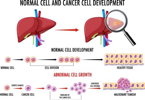 Diagram showing normal and cancer cell 7094966 Vector Art at Vecteezy