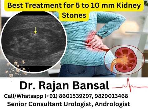 Renal Abscess: Causes, Symptoms, Diagnosis, and Treatment