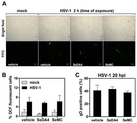 Viruses Free Full Text Nf κb Dependent Production Of Ros And Restriction Of Hsv 1 Infection