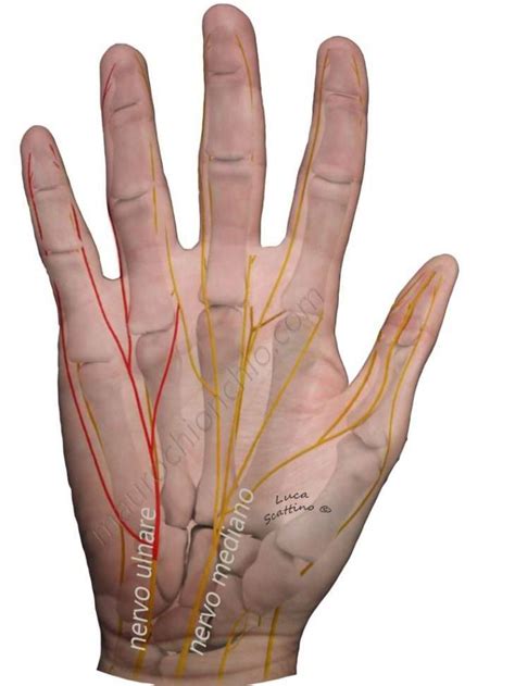 Sindrome Del Canale Di Guyon Dr Mauro Chionchio