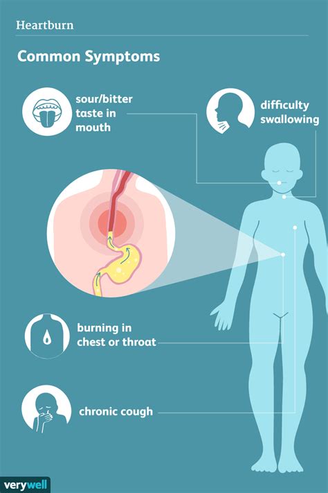 Heartburn Causes