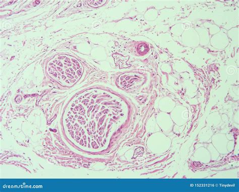 Histologia Do Tecido Adiposo Humano Foto De Stock Imagem De Patologia