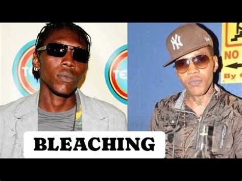 Yardchat Reacts To Vybz Kartel Bleaching His Skin Health Concerns