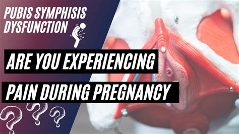 What Is Pubis Symphisis Dysfunction Painful Sheering Pain During