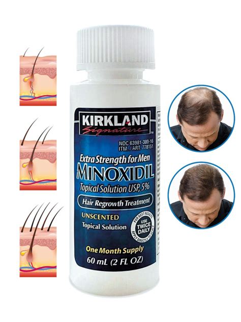 Kirkland Signature Minoxidil Topical Solution For Men Sold Per Pice