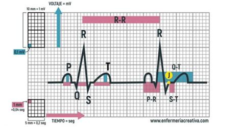 Como Interpretar Um Eletrocardiograma Sololearn