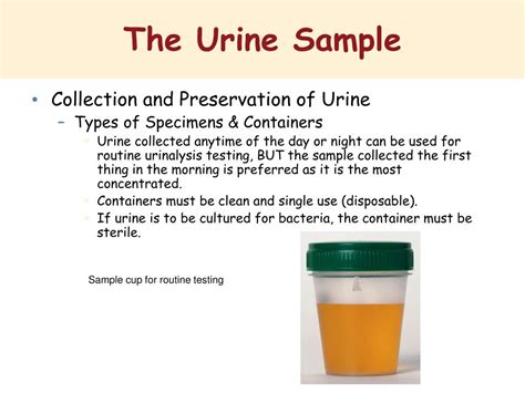 Ppt Basic Examination Of The Urine Specimen Powerpoint Presentation Free Download Id6185977