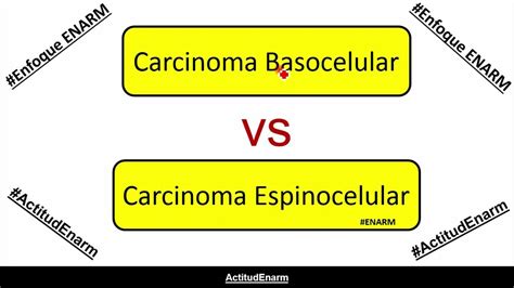 Carcinoma Basocelular Carcinoma Espinocelular Enarm Youtube