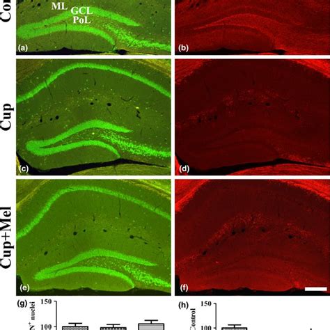 Immunohistochemistry For Ki In The Hippocampal Dentate Gyrus Of The