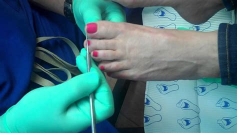 The Proper Way To Trim Your Toenails Youtube