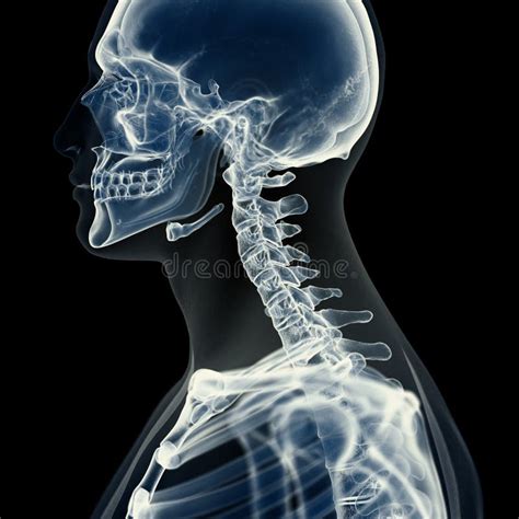 The Cervical Spine Stock Illustration Illustration Of Skeleton