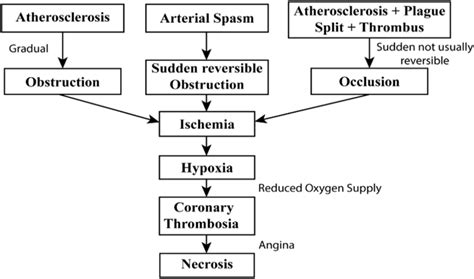 Myocardial Infarction Pathophysiology Concept Map Map Of World | The ...