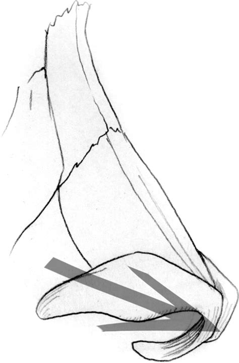 Figure 16 From Applied Surgical Anatomy Of The Nose Semantic Scholar