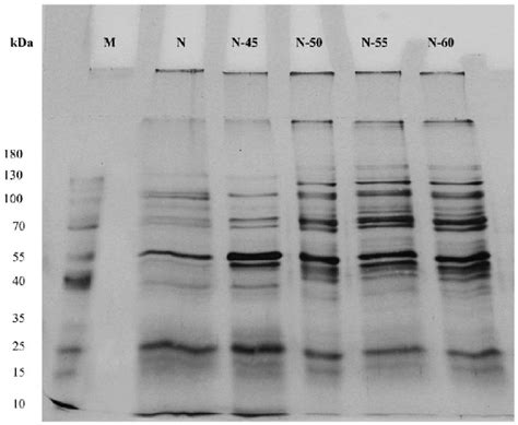 Sds Page Analysis Of Intracellular Proteins Extracted From