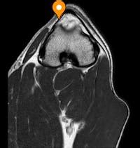 Medial patellar retinaculum - vet-Anatomy - IMAIOS