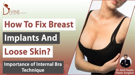 How To Fix Breast Implants And Loose Skin Importance Of Internal Bra Technique Youtube