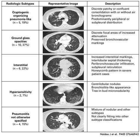 Immune Related Adverse Events From Checkpoint Inhibitors Emcrit Project