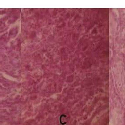 (Photomicrographs; H&E stain, ×100) A: Features of the epidermoid ...