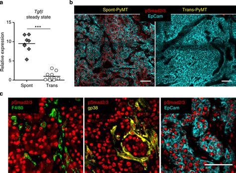 Tgf Expression Is Associated With Psmad In Spont Pymt Tumors A