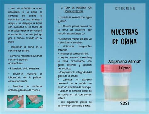 Tr Ptico De Muestras De Orina Alejandra Asmat Udocz