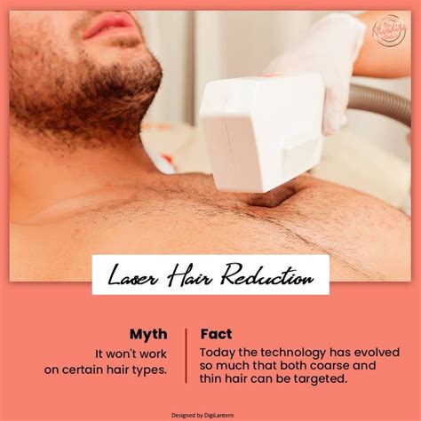 Laser Hair Removal — Myths And Facts That You Should Know By Full