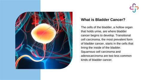 Ppt Understanding Bladder Cancer Causes Symptoms Diagnosis And Treatment Options Powerpoint