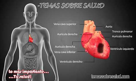 6 Enfermedades Del Corazón Que Pueden Afectar Tu Salud